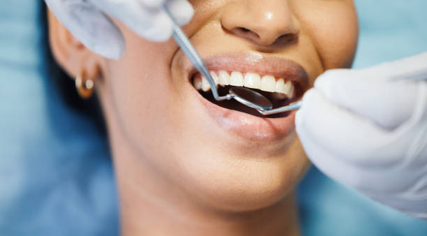 Best Emergency Wisdom Teeth Removal in Mckenzie, TN